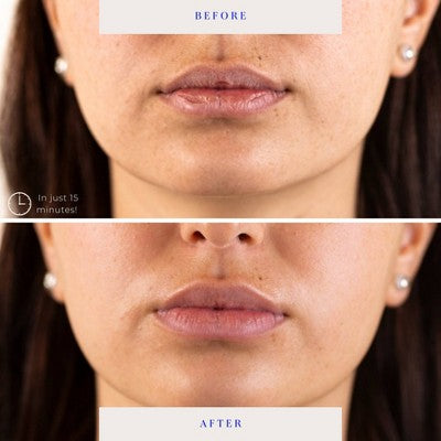 BioRepublic SkinCare Lip Masks 6pk - New